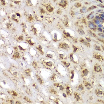 SGK1 / SGK Antibody