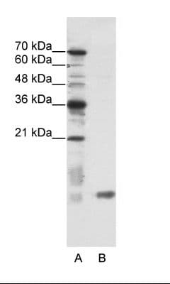 SLIRP / C14orf156 Antibody (aa51-100)