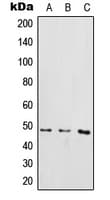 IKBKG / NEMO / IKK Gamma Antibody (phospho-Ser85)