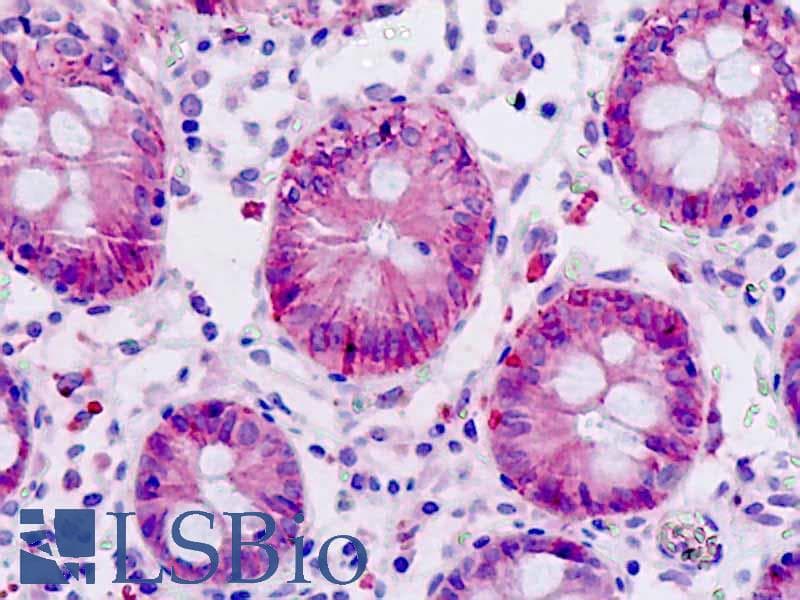 IHC-plus™ Polyclonal Rabbit anti-Human YAP / YAP1 Antibody (aa93-142, IHC, WB)