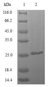 Mycobacterium tuberculosis M. tuberculosis MPT64 Protein (Recombinant 10His, N-terminus)
