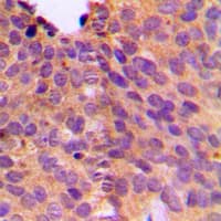 NT5C1B Antibody (Internal)