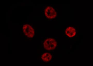 SOX9 Antibody