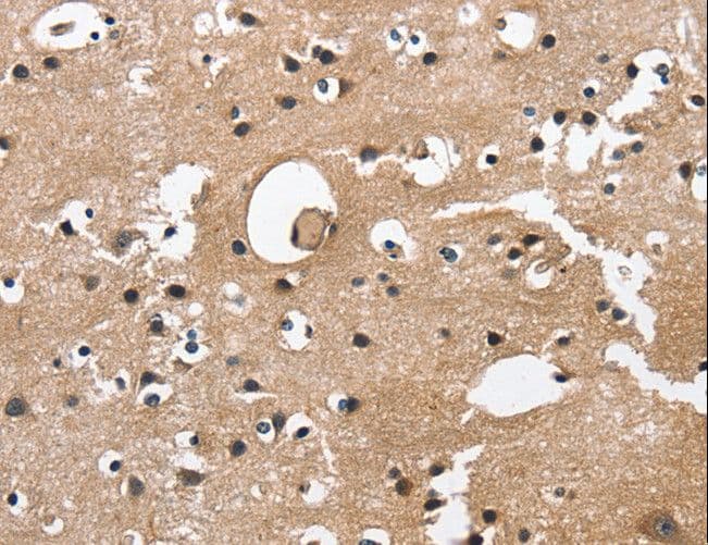 CAMK1D Antibody