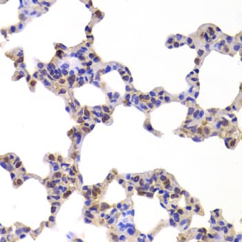 NR5A2 / LRH-1 Antibody