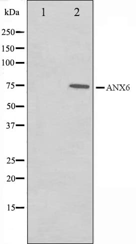 ANXA6/Annexin A6/Annexin VI Antibody