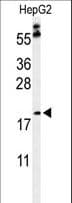 Polyclonal Rabbit anti-Human PXMP2 Antibody (aa40-68, WB)