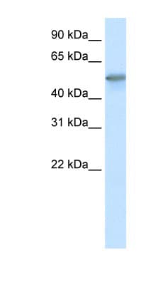 Polyclonal Rabbit anti-Human FOXO3 / FOXO3A Antibody (C-Terminus, IHC, WB)