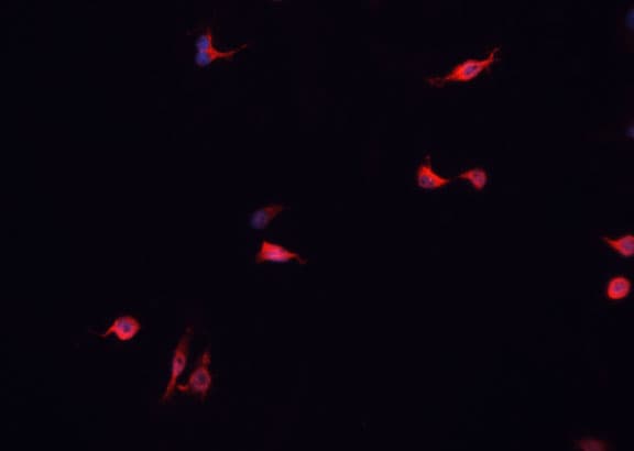 Polyclonal Rabbit anti-Human DUSP16 / MKP7 Antibody (IF, WB)
