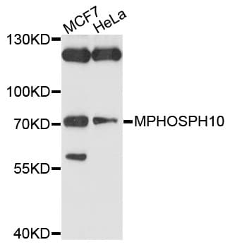 MPHOSPH10 / MPP10 Antibody