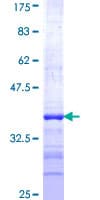 Human NEU2 / Sialidase 2 Protein (Recombinant GST, N-terminus)
