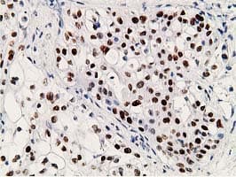 TP53 / p53 Antibody (clone OTI2C4)