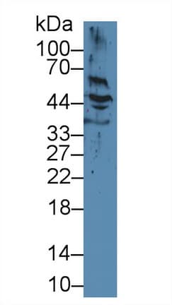 KRT17 / CK17 / Cytokeratin 17 Antibody