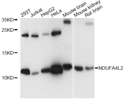 NDUFA4L2 Antibody