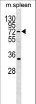 HIC2 Antibody (aa311-338)