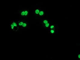 LOX / Lysyl Oxidase Antibody (clone OTI10D11)