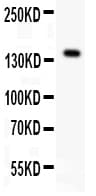 FLT1 / VEGFR1 Antibody (N-Terminus)