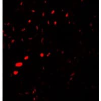 AQP2 / Aquaporin 2 Antibody