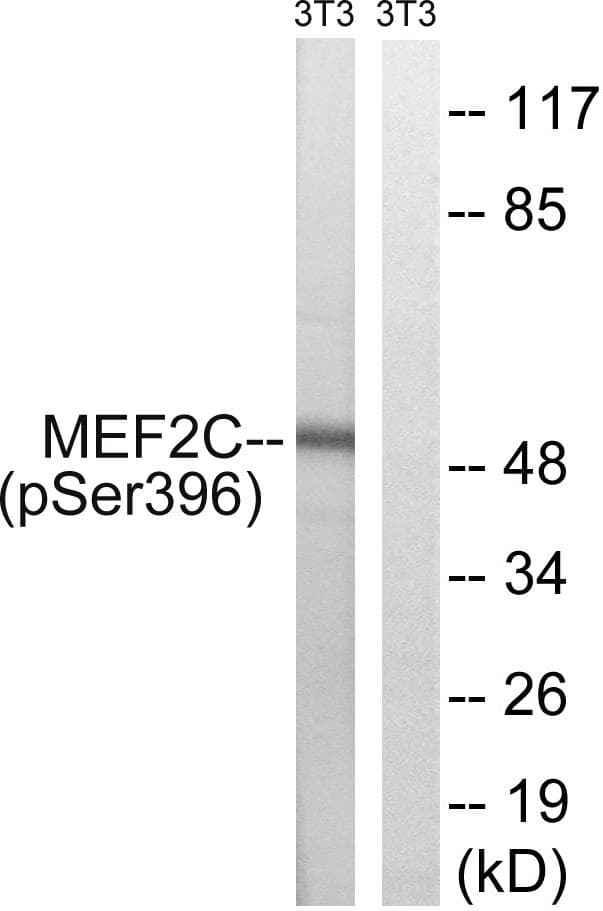 MEF2C Antibody (phospho-Ser396)