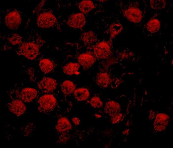 Polyclonal Rabbit anti-Human POP1 Antibody (aa925-975, IHC, IF)