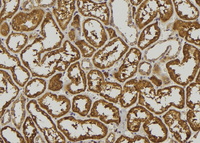 IFNA5 / Interferon Alpha 5 Antibody