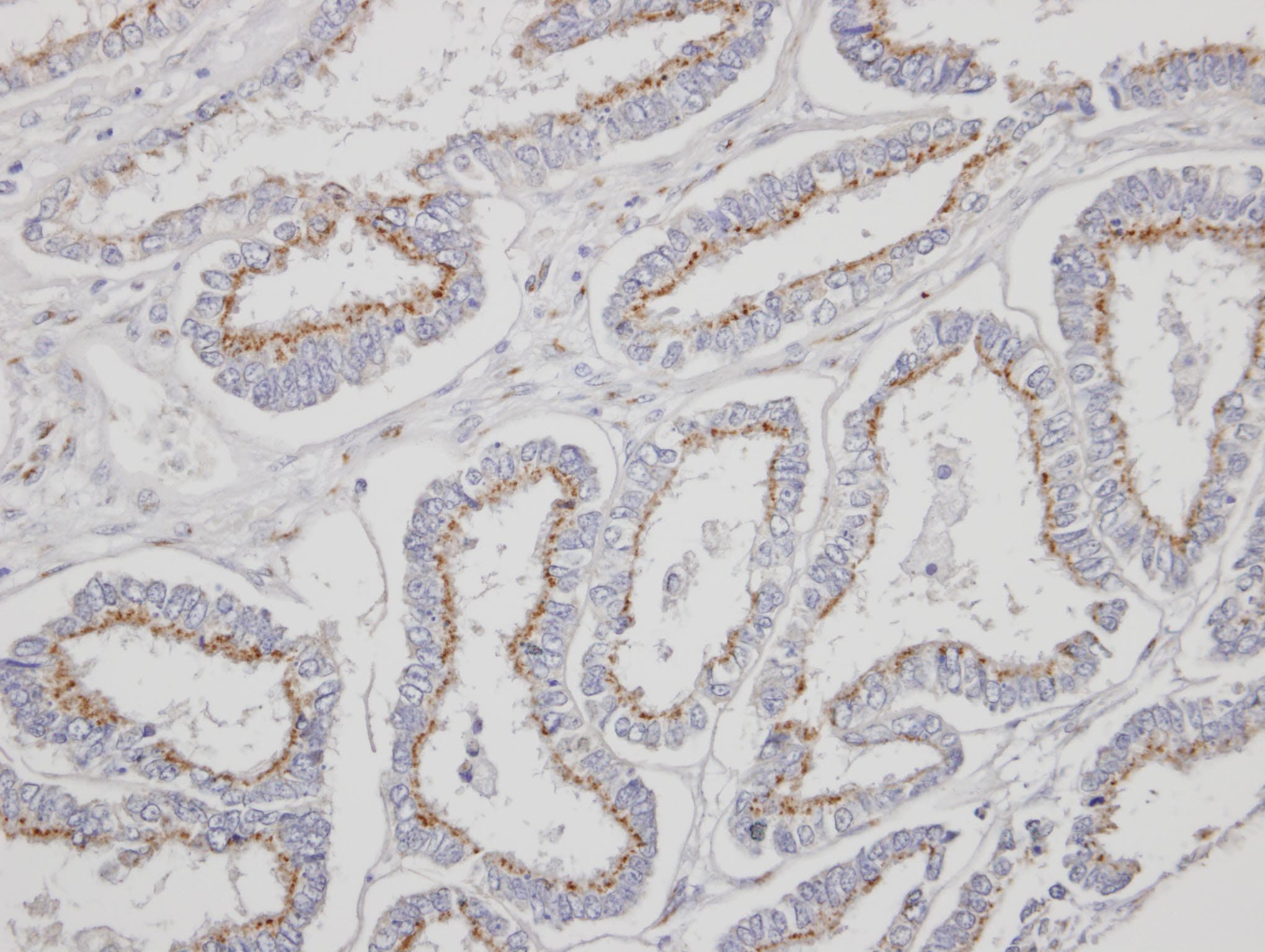 YIPF4 Antibody (aa1-192)