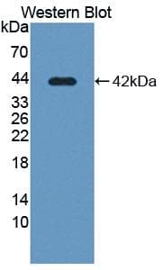 SLC39A6 / LIV-1 Antibody (aa29-325, Biotin)