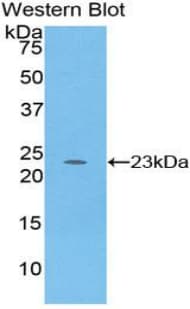PRSS1 / Trypsin Antibody (aa51-228)