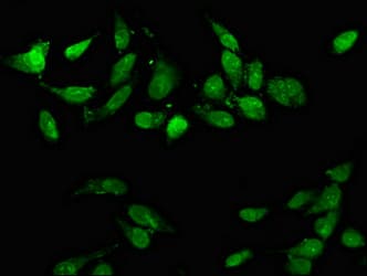 Polyclonal Rabbit anti-Human CD3EAP Antibody (IHC, IF, WB)