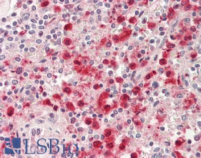 PYGL Antibody (HRP)