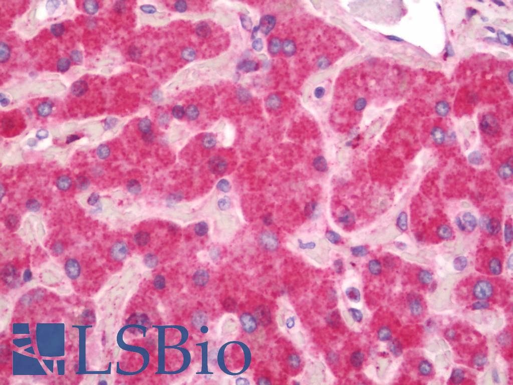 IHC-plus™ Polyclonal Rabbit anti-Human HSP90B1 / GP96 / GRP94 Antibody (aa16-43, IHC, IF, WB)