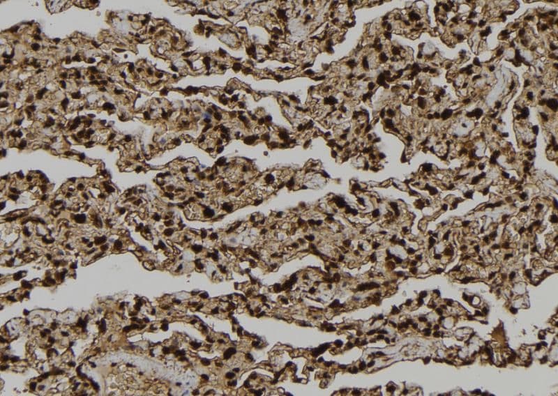 LATS2 Antibody
