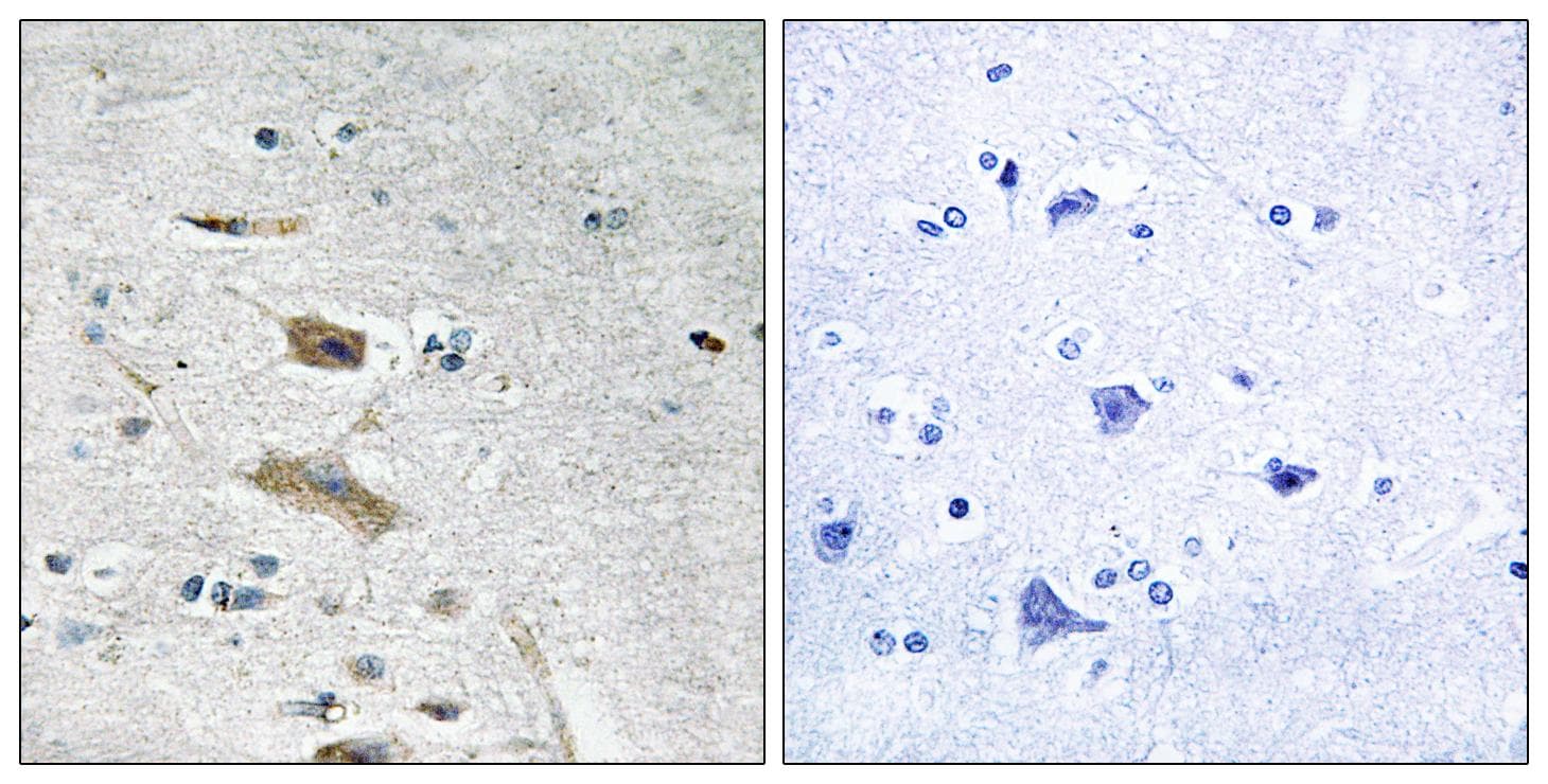 Polyclonal Rabbit anti-Human ABHD4 Antibody (IHC)