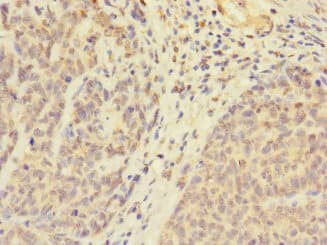 UBXD6 Antibody