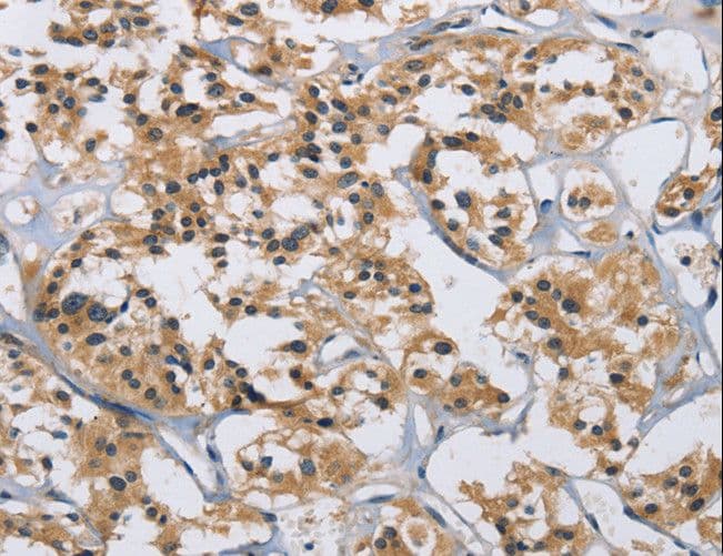 IL12RB2 Antibody