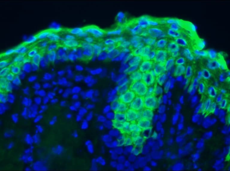 Monoclonal Mouse anti-Human KRT10 / CK10 / Cytokeratin 10 Antibody (clone RKSE60, IHC, WB)