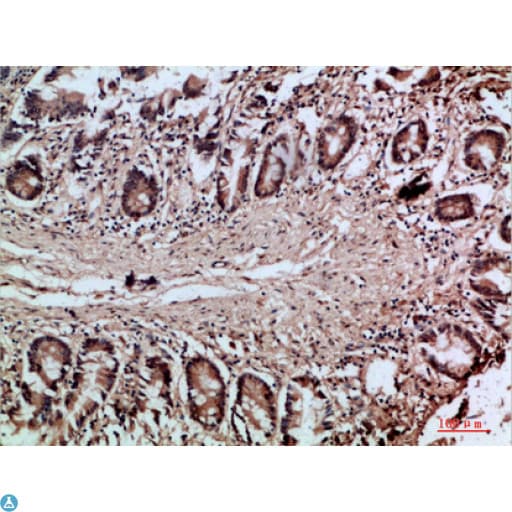 VIL1 / Villin Antibody
