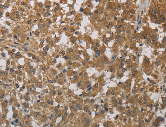 CYB5A / Cytochrome b5 Antibody