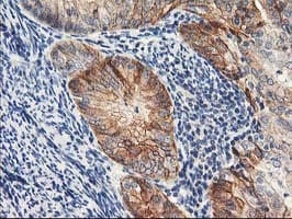 NAPE-PLD Antibody (clone OTI7B9)