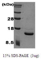 Human IL2 Protein (Recombinant)