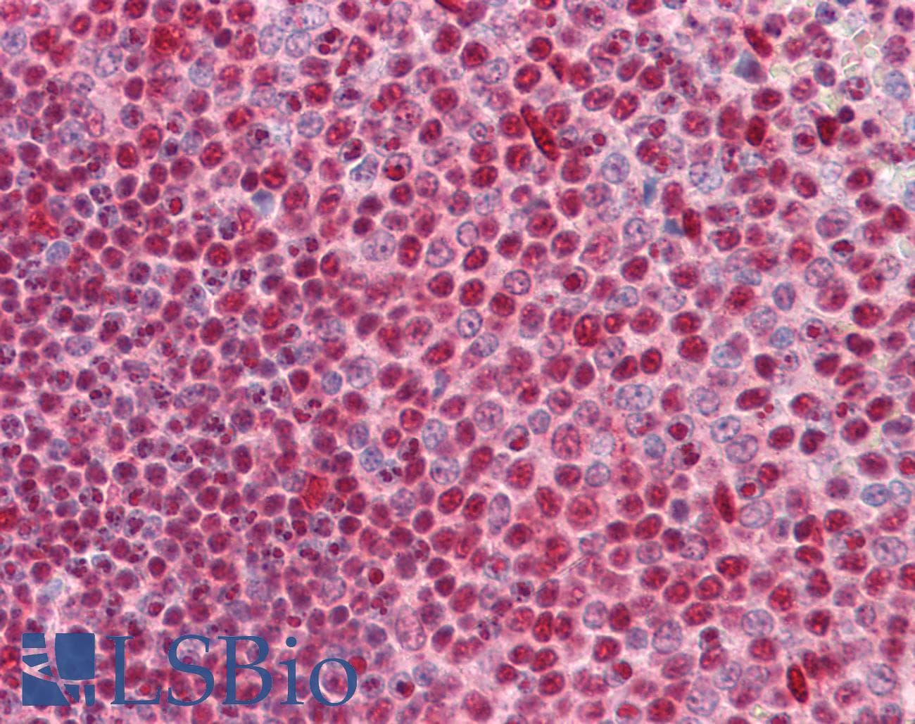 IHC-plus™ CUX1 / CASP Antibody (clone 2A10)