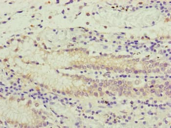 Polyclonal Rabbit anti-Human PCDHA12 Antibody (IHC)