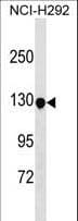 Polyclonal Rabbit anti-Human c-Kit / CD117 Antibody (aa252-281, WB)