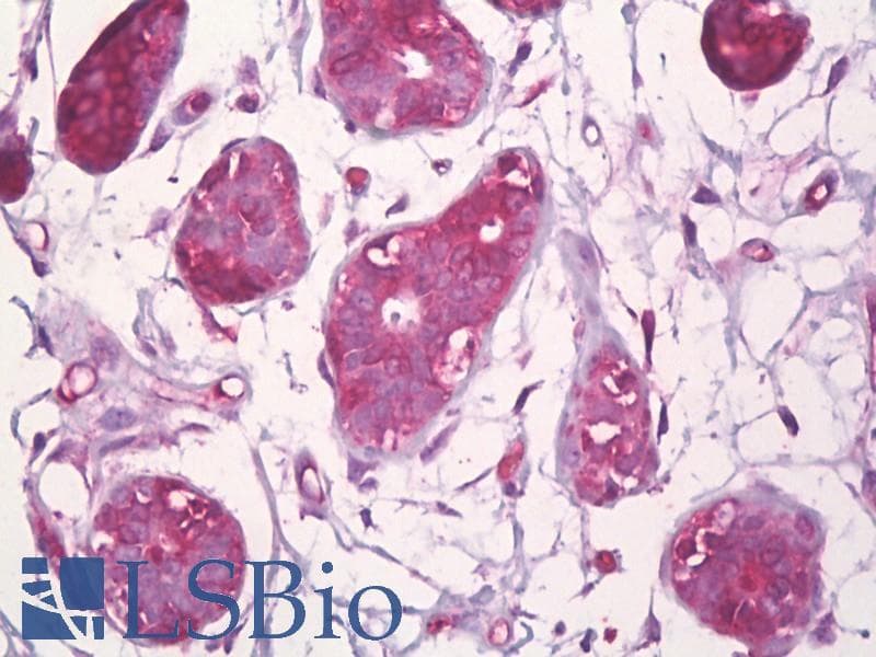 IHC-plus™ Polyclonal Rabbit anti-Human CBFB Antibody (aa11-60, IHC, WB)