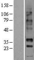 NPBWR1 / GPR7 Protein (Over-Expression Lysate Myc-DDK (Flag))