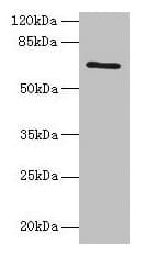 Polyclonal Rabbit anti-Human HEATR9 Antibody (IHC, WB)