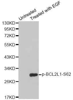 Polyclonal Rabbit anti-Human BCL2L1 / BCL-XL Antibody (phospho-Ser62, IHC, IF, WB)