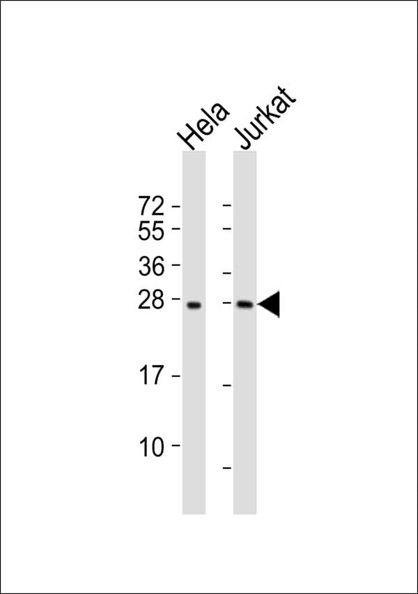 RPL10 / Ribosomal Protein L10 Antibody