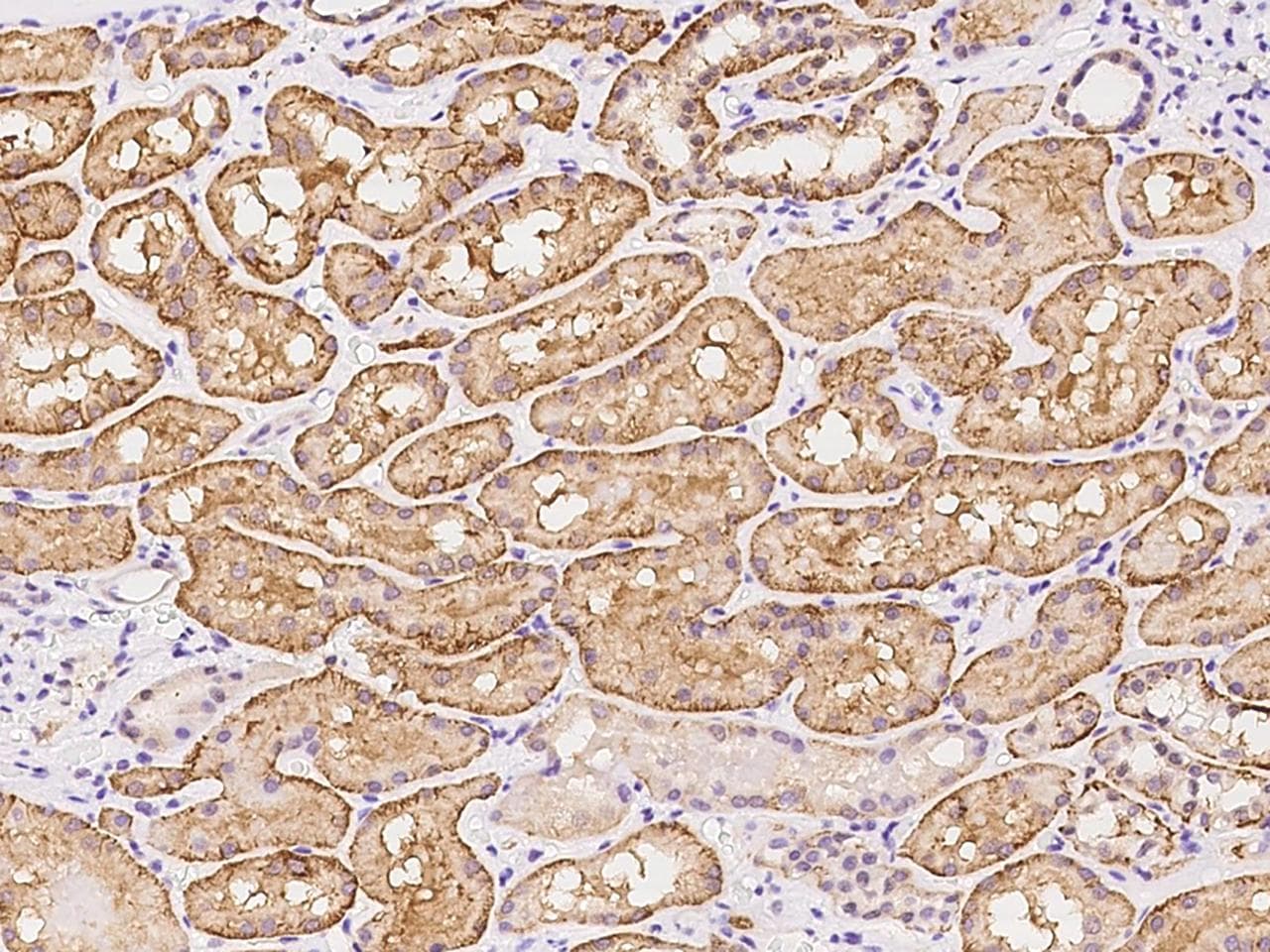 LIMCH1 Antibody