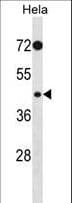 PHKG2 Antibody (aa41-71)